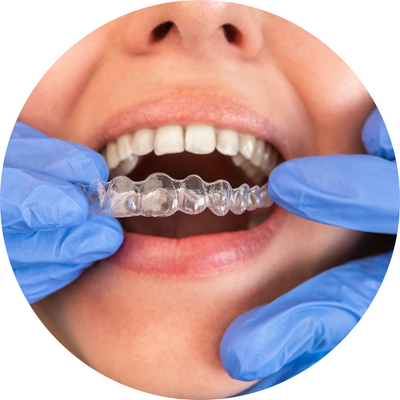 Invisalign - Atual Odonto | Dra. Camila Jandozo | Odontologia Especializada | Jardim Amanda - Hortolândia